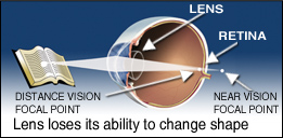 Lens-Lose-Their-Ability-to-Adapt